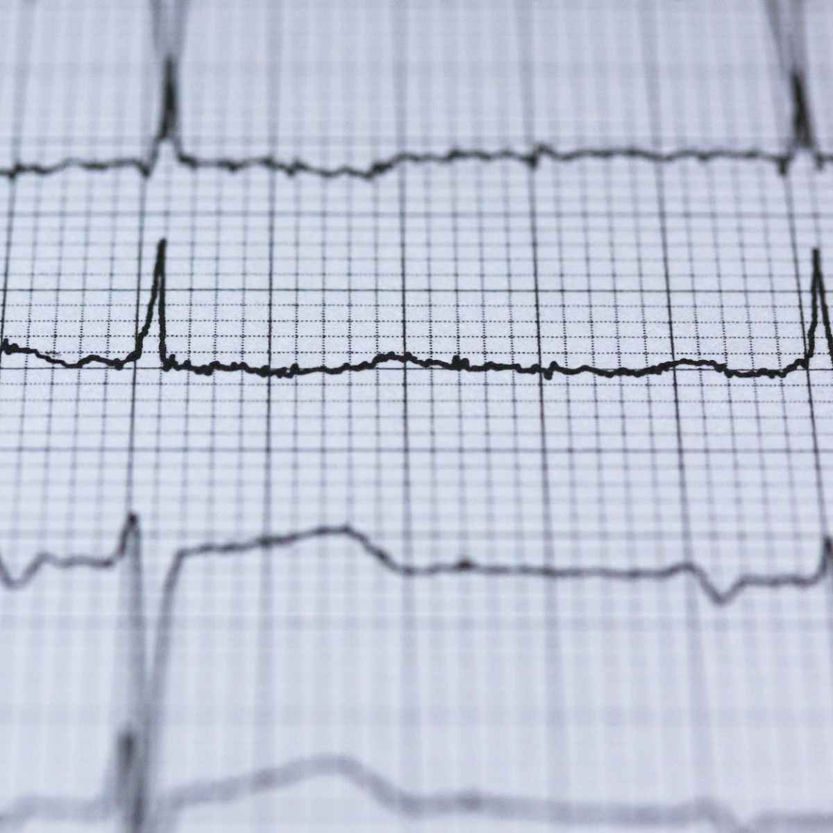 Want a healthy heart? Prioritize Quality&nbsp;Sleep